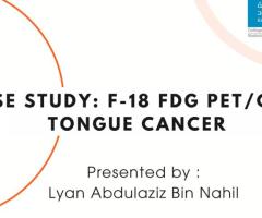 Tongue Cancer ( FDG PET-CT )