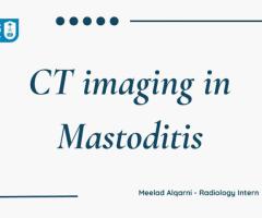 CT Imaging in the Diagnosis and Evaluation of Mastoiditis: A Case Study