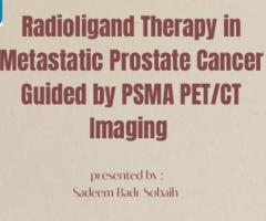 Radioligand Therapy