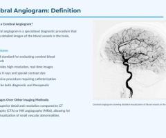Cerebral Aneurysm