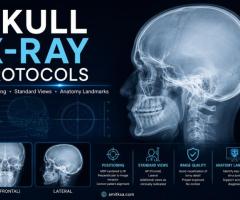 Lines of skull projections