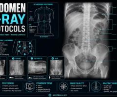 X-ray abdomen erect only