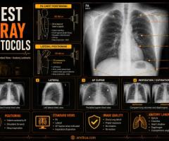 X-ray chest AP only supine (adult)