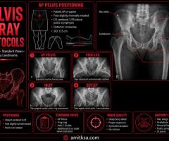 X-ray pelvis AP routine