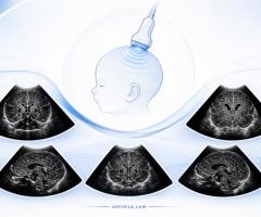 Neonate head