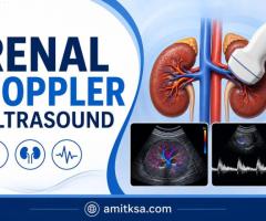 Renal doppler