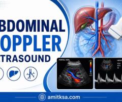 Abdominal doppler