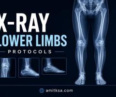 X-ray patella skyline view (3 views)